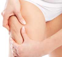 Cellulite Reduction